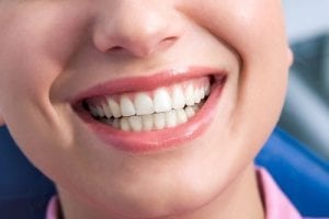 Close-up of happy female showing her healthy teeth in smile-img-blog