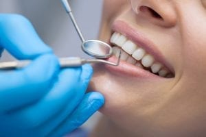 Dental check up on woman teeth