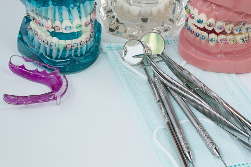 Tooth molds with braces next to orthodontics equipment.