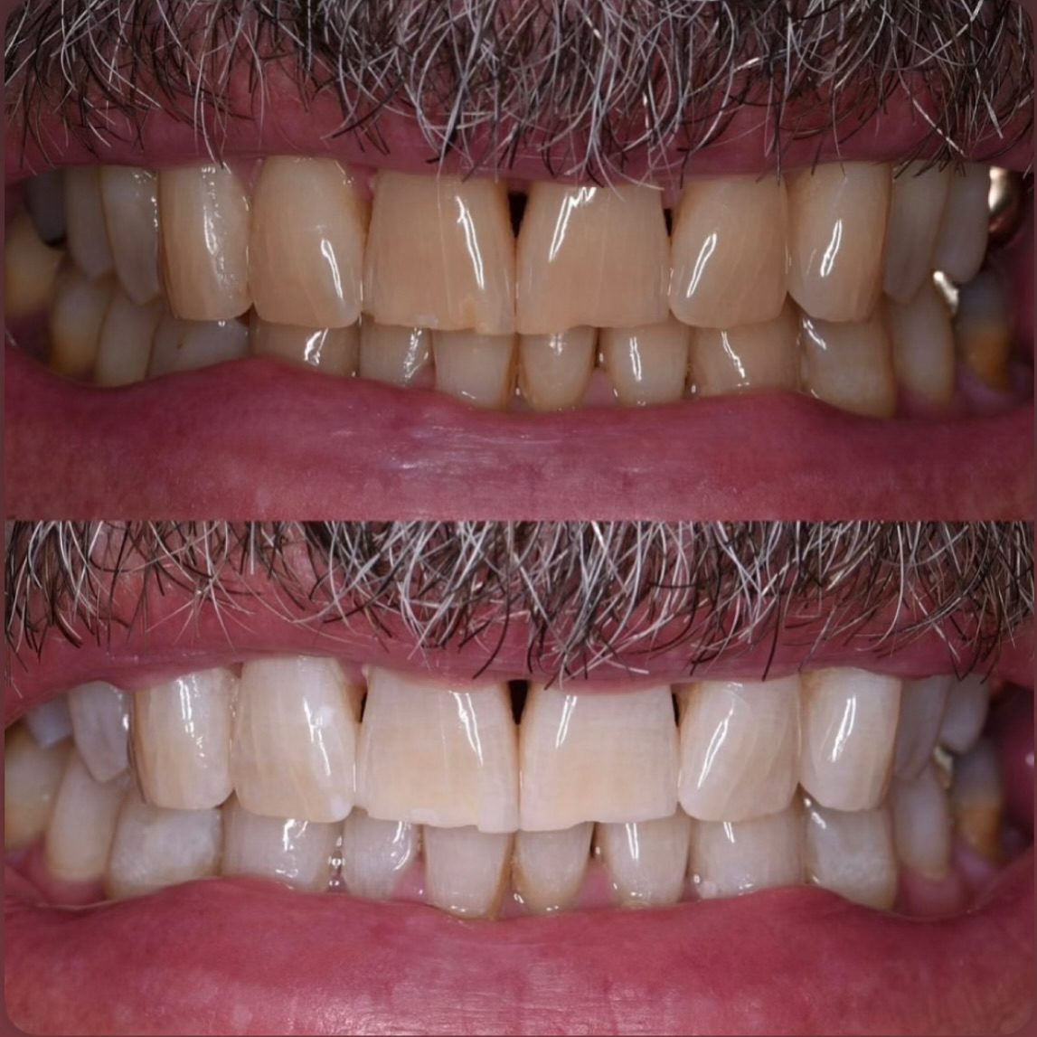 Instagram Feed Post 3