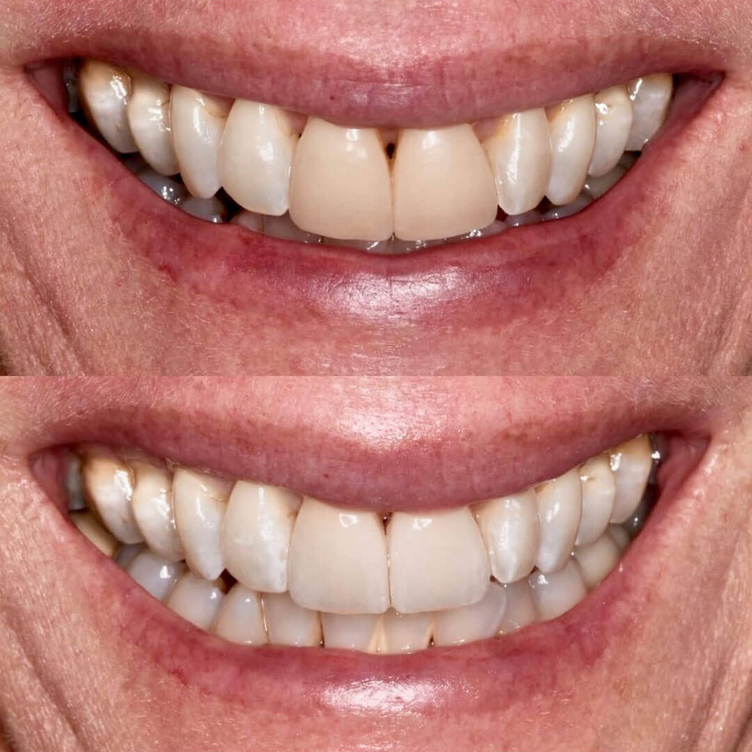 Instagram Feed Post 5