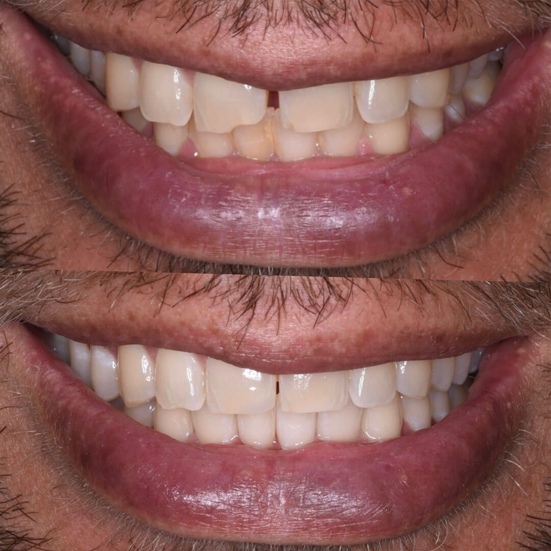 Instagram Feed Post 8